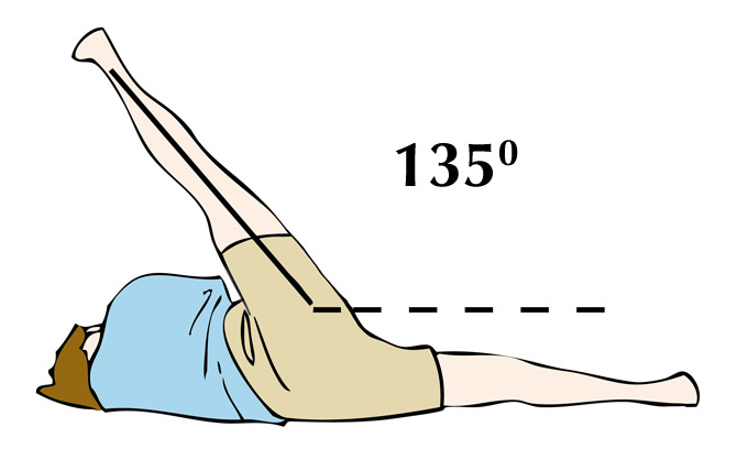 135 Degree Hip Abduction